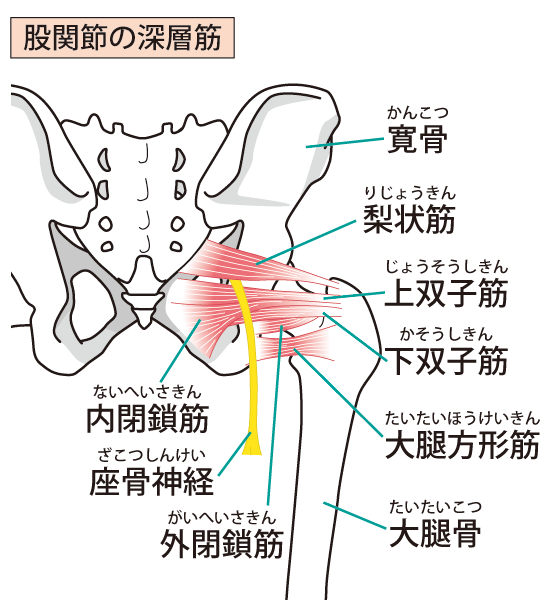 梨状筋症候群