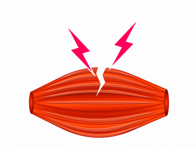 肉離れのイラスト